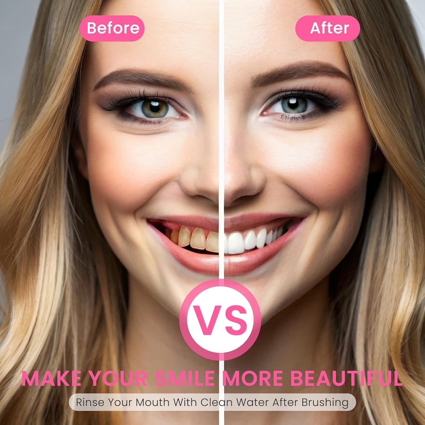 Shyne™ Whitening Toothpaste