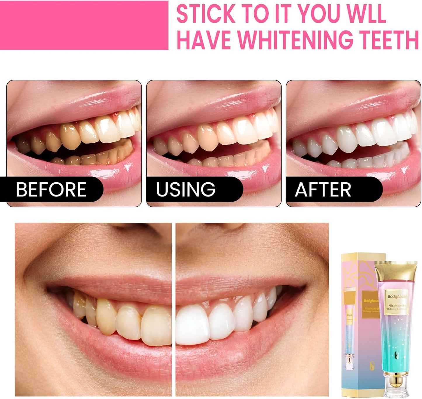 Shyne™ Whitening Toothpaste