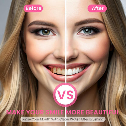 Shyne™ Whitening Toothpaste